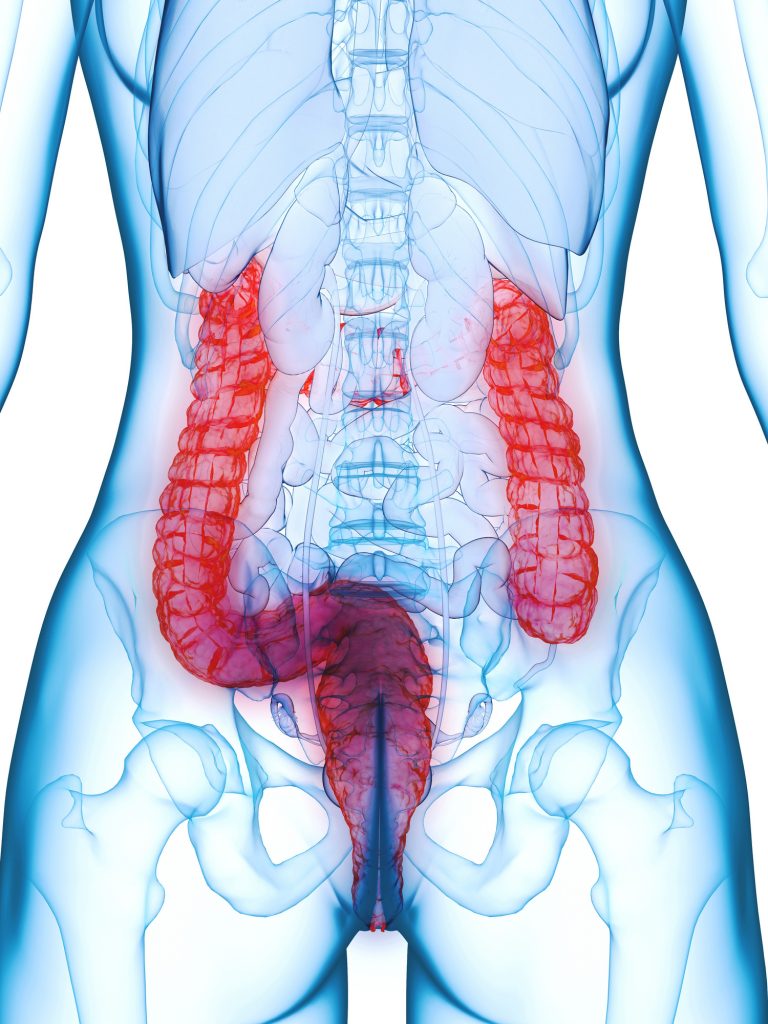 Blood Biomarker Predicts Severe Crohn’s Disease Years Before Diagnosis