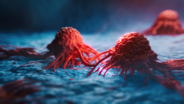 Cancer Cells Directly Targeted by Chemotherapy-Loaded Nanovesicles