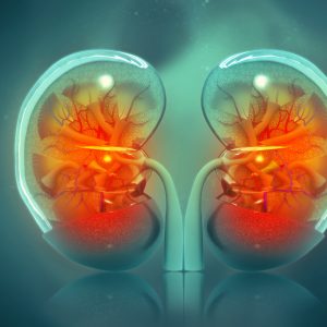 AI Predicts Kidney Complications Following Hospitalization