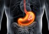 PIEZO2 Is Independent Risk Factor for Gastric Cancer and Possible Therapeutic Target