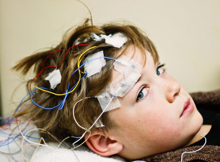 SCN2A Phenotype Analysis Could Improve Outcomes for Childhood Epilepsies