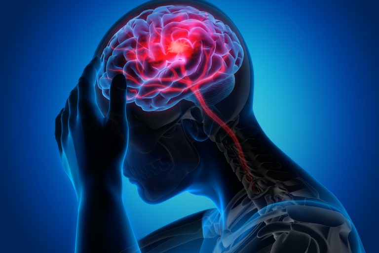 Illustration of a person holding their head in their hand with the brain highlighted in red and showing signs of ischemic stroke