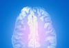 Deep Brain Stimulation Pinpoints Neurological Disorders