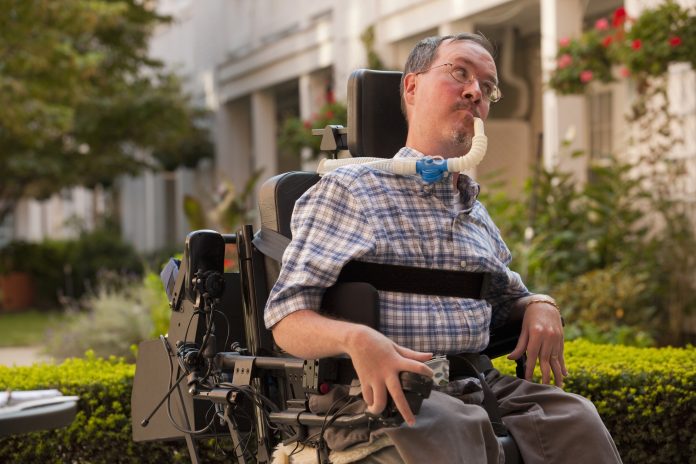 Man with Duchenne muscular dystrophy sitting in a motorized wheelchair using power controller with degenerated hands