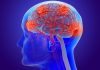 Study Reveals Targetable Factors to Reduce Risk of Young-Onset Dementia