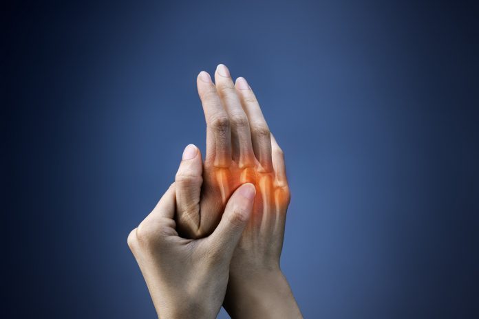 Picture showing hands affected by rheumatoid arthritis