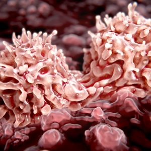 Antiviral T Cells Prove Useful for Debilitating Stem Cell Transplant Side Effect