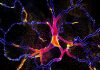 Protein Allows Production of Norepinephrine Neurons from Stem Cells, with Implications for Alzheimer’s and Parkinson’s Research