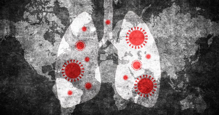 image of lungs with SARS-CoV-2 particles on them to indicate infection and lung damage from COVID-19