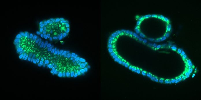 Swelling response of patient derived mini-guts. Collapsed organoids (left) show active swelling response that is mediated by the CFTR ion channel after one hour incubation with forskolin (right). Green staining shows complete cells (Calcein green) and DNA is shown in Blue.