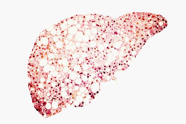 Mice with Obesity Return to Normal Weight with Nanogel-Based Delivery to Liver