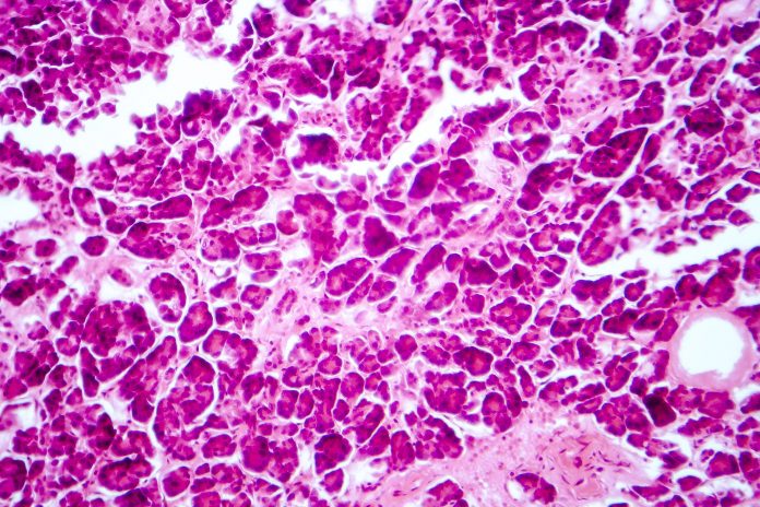 Histology of human pancreatic tissue to illustrate hyperinsulinism