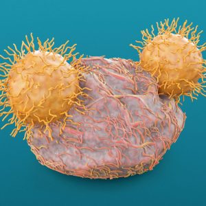 Study Significantly Improves CAR T Cell Therapy for Solid Tumors
