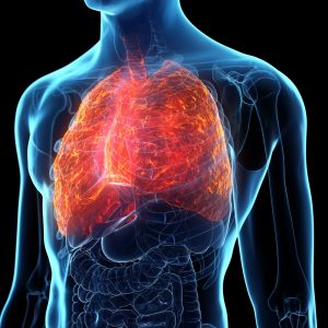 Cancer Drugs Could Be Used to Treat Pulmonary Hypertension