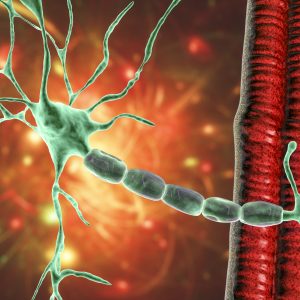 FDA Approves TG Tx’s BRIUMVI for Relapsing Multiple Sclerosis