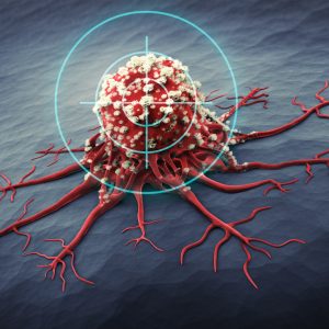 Cancer Clinical Trial Matching Improved by Computer Platform