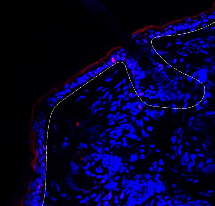 In inflamed skin keratinocytes with the receptor for interleukin-12 divide less (this image) than keratinocytes without this receptor. Red: cells during division, blue: cell nuclei, white line: epidermis (outermost skin layer consisting of keratinocytes). (Image: UZH)