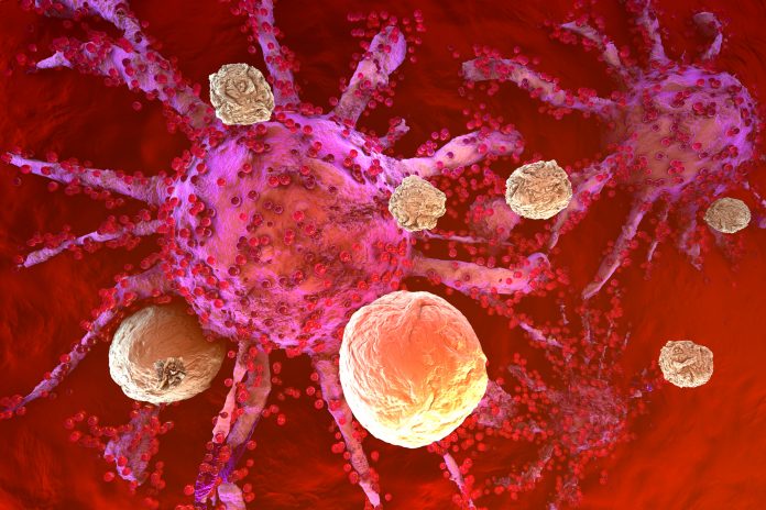 3D rendered Illustration of T-Cells of the immune System attacking growing Cancer cells. Gamma delta T cells engineered to attack solid tumors