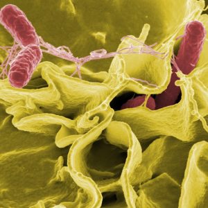 Inexpensive, Efficient Approach Developed to Make Pathogen Sequencing More Accessible