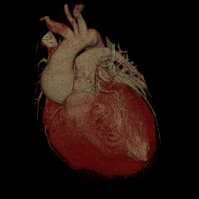 3D computed tomography reconstruction of the heart