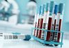 FDA-Cleared Alzheimer’s Blood Test Marks a Shift Toward Earlier, Less Invasive Diagnosis