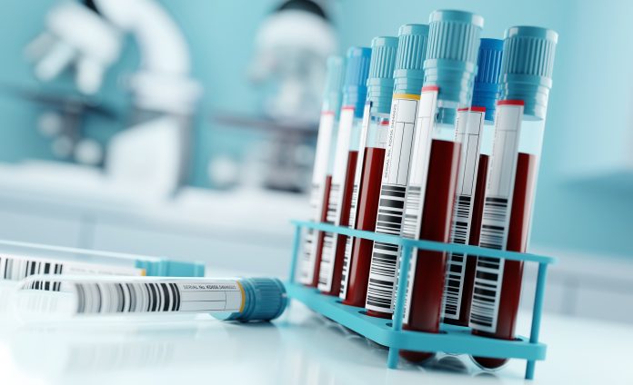 Blood Test Results In A Medical Lab