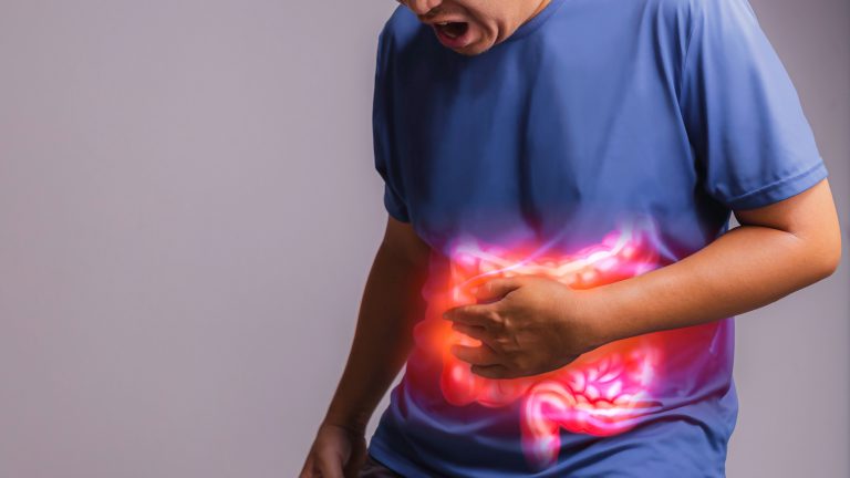 Genetic Predisposition to Irritable Bowel Syndrome Uncovered
