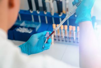 Close up of human biotechnologist testing testing blood for cancer in a laboratory