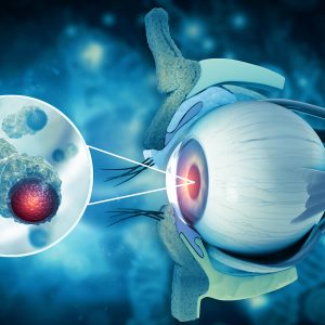 Immunocore’s KIMMTRAK for Unresectable or Metastatic Uveal Melanoma Gets FDA Approval