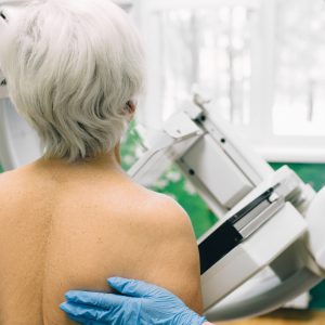 Breast Cancer Overdiagnosis from Mammograms May Be Half What Was Feared