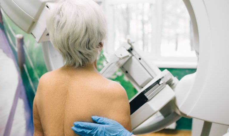Breast Cancer Overdiagnosis from Mammograms May Be Half What Was Feared