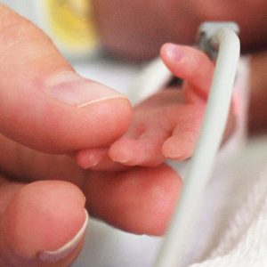 Rapid WGS, Combined with Other Data Improves Diagnoses of Critically Ill Infants