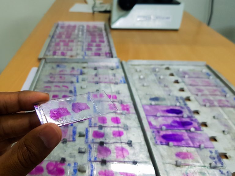 hand, holding histopathology slides stained with leishman stain, displayed and ready for microscopy.