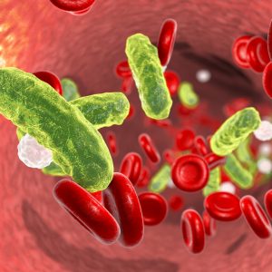 Blood-Based Diagnostic Cuts Time to Infection Detection