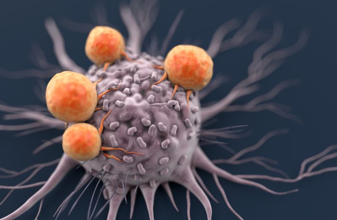 Cancer cell attacked by Lymphocytes