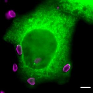 Blocking Protein Regulation of Toxoplasma Parasite Causes It to Die