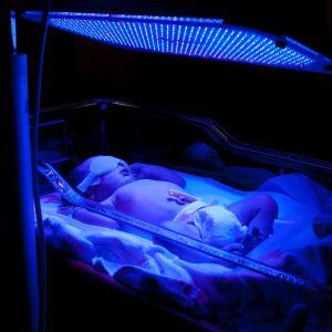 A Smartphone Based App Can Help Detect Jaundice in Babies