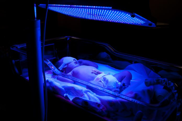 Baby with Phototherapy