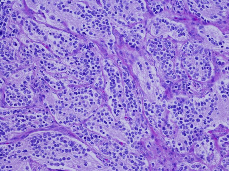 Neuroblastoma cells microscope image