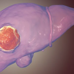 Hormone Inhibits Liver Tumor Growth in Mice