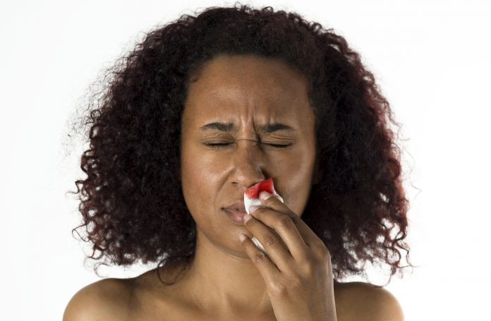 Woman With Nosebleed