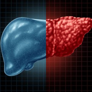 Decreases in Enzyme Linked to Nonalcoholic Fatty Liver Disease