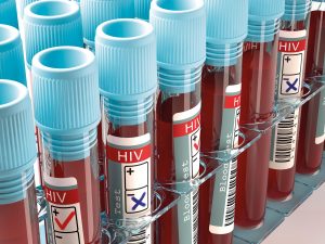 Blood samples for HIV tests