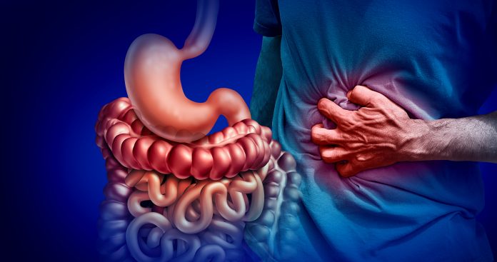 IBD, Crohn's disease