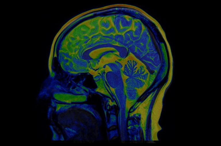 Brain MRI Scan of Healthy Male  ( Magnetic Resonance Imaging) High Resolution