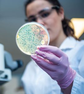Woman researcher performing examination of bacterial culture plate