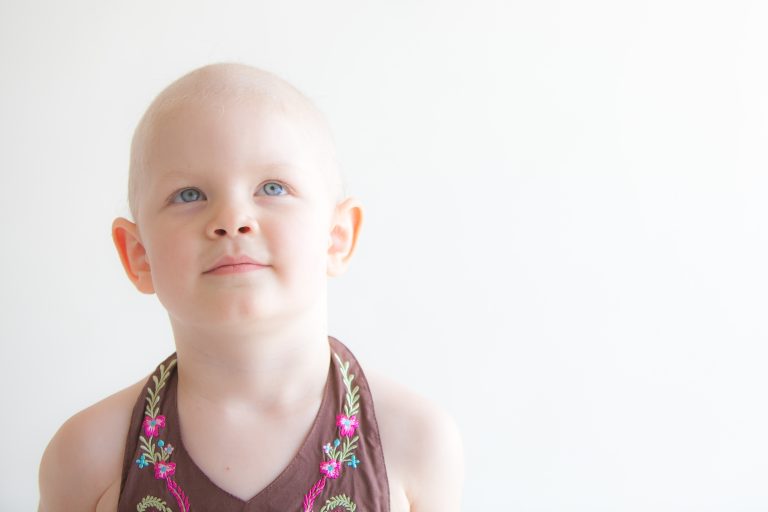 Child with cancer headshot looking up
