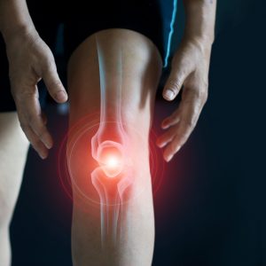 AI Detects Early Knee Osteoarthritis from X-Ray Images