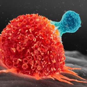 Tevogen Eyes Development of T Cells for Treatment of EBV-Related Cancers and MS