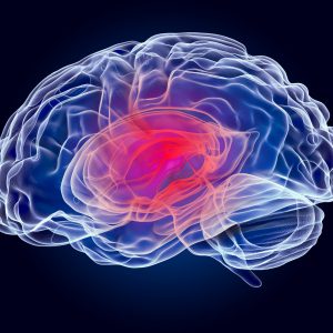 Epilepsy Drivers Related to Glioma Revealed